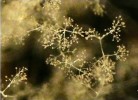 Větvičky sporangioforů druhu Dimargaris bacillispora s typickými  pučícími buňkami (budding cells). Foto A. Nováková