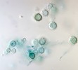 Konidie Histoplasma capsulatum mají charakteristický kulovitý tvar a jsou na povrchu pokryté výraznými výrůstky. Foto O. Koukol