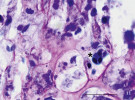 Histologický řez rybí tkání napadené rybomorkami (označené hvězdičkou). Spory rybomorky pstruží v chrupavce pstruha duhového. Barveno Giemsou – barvivem obsahujícím azur, metylenovou modř a eozin běžné využívaným k barvení mikroskopických preparátů protist a krevních roztěrů. Měřítko 20 μm. Foto P. Bartošová-Sojková 