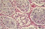 Histologický řez rybí tkání napadené rybomorkami (označené hvězdičkou). Spory a plasmodia Sphaerospora testicularis v semenotvorných kanálcích mořčáka evropského. Barveno hematoxylinem a eozinem. Měřítko 100 μm. Foto P. Bartošová-Sojková 