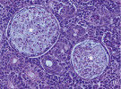 Histologický řez rybí tkání napadené rybomorkami (označené hvězdičkou). Cysty naplněné sporami Myxidium rhodei vyvíjející se v Bowmanově prostoru renálních tělísek plotice obecné (Rutilus rutilus). Barveno hematoxylinem a eozinem. Měřítko 50 μm. Foto I. Fiala