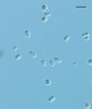 Různé tvary konidií u paličkovic: cylindrické až oválné konidie u Claviceps purpurea s. str. Foto K. Píchová