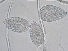 Polyfágní plíseň Phytophthora pseudosyringae byla v ČR poprvé zjištěna v r. 2015  v lužním lese v Polabí. Na snímku typická zoosporangia, uvnitř kterých se vytvářejí bičíkaté zoospory. Foto M. Mrázková