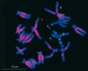 Chromozom chromozomy Y1 a Y2 u šťovíku kyselého (Rumex acetosa) jsou schopny se bránit před šířením retrotranspozonů, a tím brzdit degenerativní procesy. Červený signál – rozsah rozšíření konkrétního typu retrotranspozonu v genomu, zelený – specifická oblast pro chromozomy Y,  zde tvořená tandemovou repeticí (blíže v textu). Foto R. Hobza
