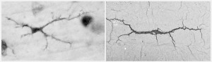Mozková mikrogliová buňka (vlevo, impregnace stříbrem podle Hortegy) a asfaltová štěrbina utvářená obdobně jako mikroglie. Foto J. Špaček