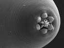 Hlavová část samice hlístovky Hetero­rhabditis beicherriana (Hetero­rhabditidae) se symbiotickými entomopatogenními bakteriemi. Foto Z. Mráček
