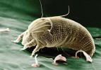 Vlnovník Aceria anthocoptes,  původce nekrotických změn na listech  i květenstvích některých druhů pcháčů (p. oset – Cirsium arvense, p. obecný –  C. vulgare). Značně snižuje jejich  vitalitu. Lokalita neuvedena.  Foto Ch. Pooley, Wikimedia Commons, v souladu s podmínkami použití
