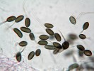 Tmavě pigmentované jednobuněčné konidie zástupce rodu Harknessia  s průhlednými (hyalinními) přívěsky jsou vytvářeny ve sporodochiích (stromatický útvar, na jehož povrchu se tvoří konidiofory) nejen na rostlinném opadu, ale i při kultivaci. Foto A. Nováková