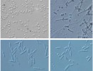 Mikrofotografie kvasinek izolovaných z lesních půd. Kvasinka Leucosporidium krtinense v jednobuněčné formě (obr. a) a s jejím vláknitým pseudomyceliem (b). Pseudomycelium je útvar tvořený  řetízky buněk, které vznikly neúplným oddělením dceřiných buněk při pučení. Vláknitého růstu bylo v tomto případě dosaženo kultivací na kukuřičném  agaru (CMA, Cornmeal Agar). Druhy Yurkovia mendeliana (c) a Libkindia masarykiana (d). Foto T. Mašínová