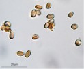 Nepohlavní spory – konidie  C. corticale. Foto I. Kelnarová