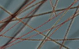 Vláknitá sinice Planktothrix  rubescens z jezera Most, zvětšení 400×.  Foto P. Znachor