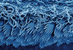Mikrofotografie povrchu skolexu (mikrotrichy) tasemnice rodu Echinobothrium z rejnoka rodu Pastinachus, Indonésie. Skenovací elektronový  mikroskop, zvětšeno 10 000 ×. Foto R. Kuchta