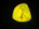 Snímek juvenilního jedince škeble říční (Anodonta anatina) krátce po odpadnutí z hostitelské ryby pořízený fluorescenčním  mikroskopem s využitím lipidově  selektivního barviva Nile Red  (šířka ca 370 μm). Fluorescence je  nejintenzivnější v místech zvýšené  akumulace tukových zásob. Foto K. Douda