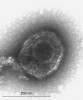 Vir Herpes simplex 1 (HSV-1) je v latentním stavu ukryt v gangliu trojklaného nervu a k reaktivaci dochází vlivem oslabení imunity.  Foto D. Krsek, Národní referenční laboratoř pro průkaz infekčních agens elektronovou mikroskopií, Státní zdravotní ústav 