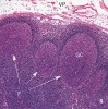 Kůra lymfatické uzliny.  VP – vazivové pouzdro uzliny, F – folikuly, GC – germinální centrum folikulu.  Barveno hematoxylin-eosinem, objektivní zvětšení 5×. Foto M. Jirkovská