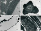 Ultrastruktura fosilií hmyzu z jantaru (TEM): obr. a – příklad  zachování ultrastruktury kutikuly  a epidermis u některých hmyzích fosilií z baltského jantaru; b – příčný řez  smyslovou senzilou zástupce  brachycerních dvoukřídlých patrně z čeledi hrbilkovití se zachovalým  válcem uprostřed senzily (smyslové  štětinky, patrně mechanoreceptorické, registrující tlak) a epikutikulou na jejím povrchu; c – podélný řez tracheálním vakem neurčeného brachycerního  dvoukřídlého hmyzu; d – řez kutikulou neurčeného zástupce brachycerních dvoukřídlých s částí tkáně pod  epidermis – zřetelně jsou vidět buněčné vakuoly a mitochondrie. Foto F. Weyda