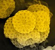 Askospory druhu Auxarthron ostraviense jsou na povrchu charakteristicky dolíčkované (12). Zvětšení  14 000×, SEM. Foto A. Kubátová