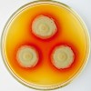 Kolonie Talaromyces marneffei (CCF 3217) jsou charakteristické produkcí výrazně  červeného pigmentu na Czapkově agaru s kvasničným extraktem i na některých jiných médiích. Foto A. Kubátová