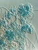 Konidiofory druhu Talaromyces marneffei připomínají stavbou  příbuzný rod štětičkovec (Penicillium), do něhož byl tento druh houby dříve i řazen. Zvětšení 1 000×. Foto A. Kubátová