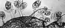 Plísenka Epistylis helicostylum z nožek lasturnatky rodu Eucypris  (Ostracoda). Báze zoitů jsou chráněny miskovitými výrůstky stonku. Foto J. Vávra 