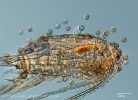 Brousilka vznášivková (Trichodina diaptomi) – forézní symbiont (blíže v textu) na povrchu vznášivky Diaptomus sp. Foto M. Plewka, www.plingfactory.de, Německo 