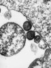 Virus lidské imunodeficience (HIV). Lipidický obal získávají retroviry pučením z infikované hostitelské buňky. Do cytoplazmatické membrány jsou inkorporovány virem kódované proteiny (produkty genové oblasti env), které vyčnívají z buněčné (a po vypučení z virové) lipidické dvojvrstvy. Foto H. M. Lairdová